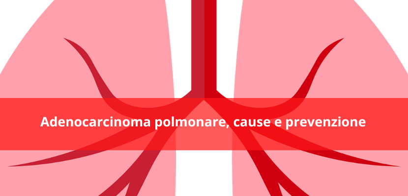 adenocarcinoma polmonare