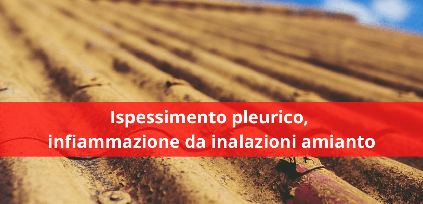 ispessimento pleurico