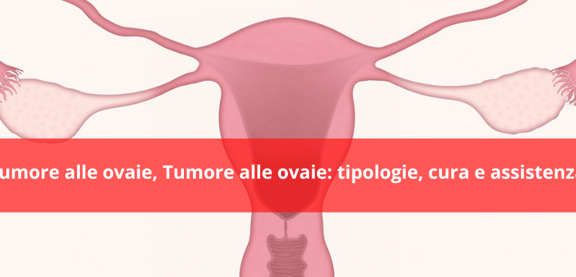 tumore alle ovaie