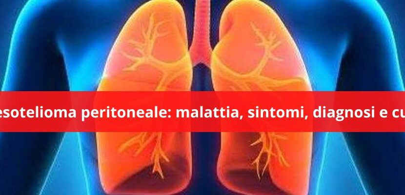 mesotelioma peritoneale